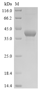 Recombinant Escherichia coli DNA adenine methylase (dam) - image 1