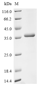 (Tris-Glycine gel) Discontinuous SDS-PAGE (reduced) with 5% enrichment gel and 15% separation gel.