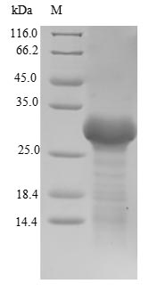 (Tris-Glycine gel) Discontinuous SDS-PAGE (reduced) with 5% enrichment gel and 15% separation gel.