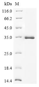 Recombinant Rat Protransforming growth factor alpha (Tgfa) - image 1