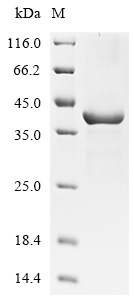 (Tris-Glycine gel) Discontinuous SDS-PAGE (reduced) with 5% enrichment gel and 15% separation gel. (Tris-Glycine gel) Discontinuous SDS-PAGE (reduced) with 5% enrichment gel and 15% separation gel.