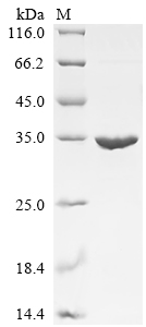 (Tris-Glycine gel) Discontinuous SDS-PAGE (reduced) with 5% enrichment gel and 15% separation gel. (Tris-Glycine gel) Discontinuous SDS-PAGE (reduced) with 5% enrichment gel and 15% separation gel.