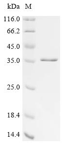 (Tris-Glycine gel) Discontinuous SDS-PAGE (reduced) with 5% enrichment gel and 15% separation gel. (Tris-Glycine gel) Discontinuous SDS-PAGE (reduced) with 5% enrichment gel and 15% separation gel.
