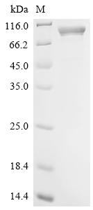 (Tris-Glycine gel) Discontinuous SDS-PAGE (reduced) with 5% enrichment gel and 15% separation gel. (Tris-Glycine gel) Discontinuous SDS-PAGE (reduced) with 5% enrichment gel and 15% separation gel.