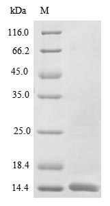 (Tris-Glycine gel) Discontinuous SDS-PAGE (reduced) with 5% enrichment gel and 15% separation gel. (Tris-Glycine gel) Discontinuous SDS-PAGE (reduced) with 5% enrichment gel and 15% separation gel.
