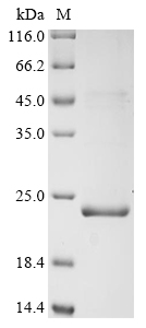 Recombinant Measles virus Phosphoprotein (P/V) , partial - image 1