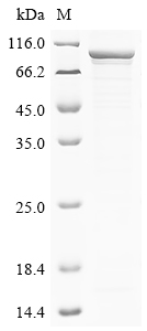 (Tris-Glycine gel) Discontinuous SDS-PAGE (reduced) with 5% enrichment gel and 15% separation gel.