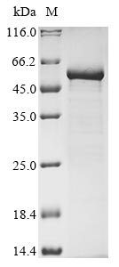 (Tris-Glycine gel) Discontinuous SDS-PAGE (reduced) with 5% enrichment gel and 15% separation gel. (Tris-Glycine gel) Discontinuous SDS-PAGE (reduced) with 5% enrichment gel and 15% separation gel.