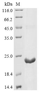 (Tris-Glycine gel) Discontinuous SDS-PAGE (reduced) with 5% enrichment gel and 15% separation gel. (Tris-Glycine gel) Discontinuous SDS-PAGE (reduced) with 5% enrichment gel and 15% separation gel.