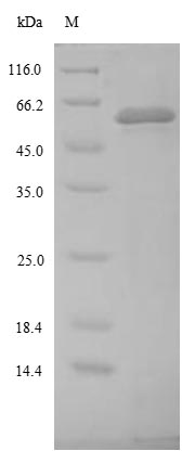 (Tris-Glycine gel) Discontinuous SDS-PAGE (reduced) with 5% enrichment gel and 15% separation gel. (Tris-Glycine gel) Discontinuous SDS-PAGE (reduced) with 5% enrichment gel and 15% separation gel.