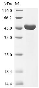 Recombinant Measles virus Nucleoprotein (N) , partial - image 1