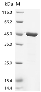 Recombinant Measles virus Nucleoprotein (N) , partial - image 1