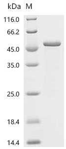 Recombinant Measles virus Nucleoprotein (N) , partial - image 1