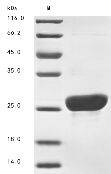 Recombinant Mouse Major urinary protein 11 (Mup11) , partial - image 1