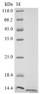 (Tris-Glycine gel) Discontinuous SDS-PAGE (reduced) with 5% enrichment gel and 15% separation gel. (Tris-Glycine gel) Discontinuous SDS-PAGE (reduced) with 5% enrichment gel and 15% separation gel.