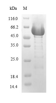 (Tris-Glycine gel) Discontinuous SDS-PAGE (reduced) with 5% enrichment gel and 15% separation gel. (Tris-Glycine gel) Discontinuous SDS-PAGE (reduced) with 5% enrichment gel and 15% separation gel.