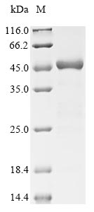 (Tris-Glycine gel) Discontinuous SDS-PAGE (reduced) with 5% enrichment gel and 15% separation gel. (Tris-Glycine gel) Discontinuous SDS-PAGE (reduced) with 5% enrichment gel and 15% separation gel.