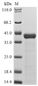 (Tris-Glycine gel) Discontinuous SDS-PAGE (reduced) with 5% enrichment gel and 15% separation gel. (Tris-Glycine gel) Discontinuous SDS-PAGE (reduced) with 5% enrichment gel and 15% separation gel.