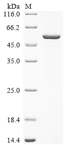 (Tris-Glycine gel) Discontinuous SDS-PAGE (reduced) with 5% enrichment gel and 15% separation gel. (Tris-Glycine gel) Discontinuous SDS-PAGE (reduced) with 5% enrichment gel and 15% separation gel.