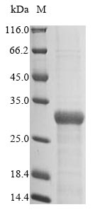 (Tris-Glycine gel) Discontinuous SDS-PAGE (reduced) with 5% enrichment gel and 15% separation gel. (Tris-Glycine gel) Discontinuous SDS-PAGE (reduced) with 5% enrichment gel and 15% separation gel.