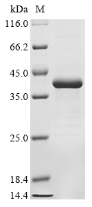 (Tris-Glycine gel) Discontinuous SDS-PAGE (reduced) with 5% enrichment gel and 15% separation gel. (Tris-Glycine gel) Discontinuous SDS-PAGE (reduced) with 5% enrichment gel and 15% separation gel.