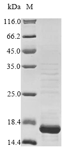 (Tris-Glycine gel) Discontinuous SDS-PAGE (reduced) with 5% enrichment gel and 15% separation gel. (Tris-Glycine gel) Discontinuous SDS-PAGE (reduced) with 5% enrichment gel and 15% separation gel.