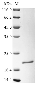 (Tris-Glycine gel) Discontinuous SDS-PAGE (reduced) with 5% enrichment gel and 15% separation gel. (Tris-Glycine gel) Discontinuous SDS-PAGE (reduced) with 5% enrichment gel and 15% separation gel.