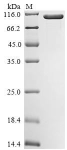 (Tris-Glycine gel) Discontinuous SDS-PAGE (reduced) with 5% enrichment gel and 15% separation gel. (Tris-Glycine gel) Discontinuous SDS-PAGE (reduced) with 5% enrichment gel and 15% separation gel.