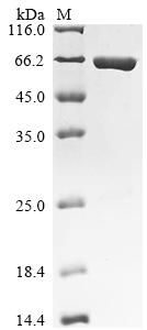(Tris-Glycine gel) Discontinuous SDS-PAGE (reduced) with 5% enrichment gel and 15% separation gel. (Tris-Glycine gel) Discontinuous SDS-PAGE (reduced) with 5% enrichment gel and 15% separation gel.