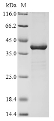 (Tris-Glycine gel) Discontinuous SDS-PAGE (reduced) with 5% enrichment gel and 15% separation gel.
