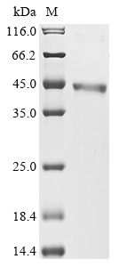 (Tris-Glycine gel) Discontinuous SDS-PAGE (reduced) with 5% enrichment gel and 15% separation gel. (Tris-Glycine gel) Discontinuous SDS-PAGE (reduced) with 5% enrichment gel and 15% separation gel.
