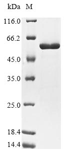 (Tris-Glycine gel) Discontinuous SDS-PAGE (reduced) with 5% enrichment gel and 15% separation gel. (Tris-Glycine gel) Discontinuous SDS-PAGE (reduced) with 5% enrichment gel and 15% separation gel.
