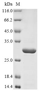 (Tris-Glycine gel) Discontinuous SDS-PAGE (reduced) with 5% enrichment gel and 15% separation gel. (Tris-Glycine gel) Discontinuous SDS-PAGE (reduced) with 5% enrichment gel and 15% separation gel.