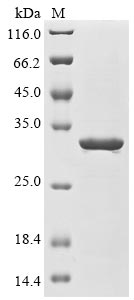 (Tris-Glycine gel) Discontinuous SDS-PAGE (reduced) with 5% enrichment gel and 15% separation gel. (Tris-Glycine gel) Discontinuous SDS-PAGE (reduced) with 5% enrichment gel and 15% separation gel.