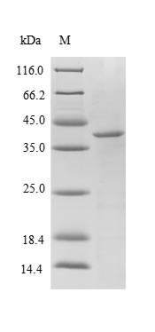 (Tris-Glycine gel) Discontinuous SDS-PAGE (reduced) with 5% enrichment gel and 15% separation gel.