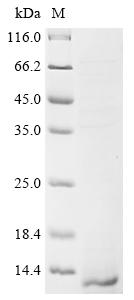 Recombinant Spinacia oleracea Plastocyanin, chloroplastic (PETE) , partial - image 1