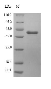 (Tris-Glycine gel) Discontinuous SDS-PAGE (reduced) with 5% enrichment gel and 15% separation gel.