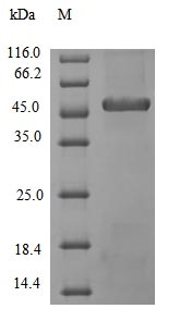 (Tris-Glycine gel) Discontinuous SDS-PAGE (reduced) with 5% enrichment gel and 15% separation gel. (Tris-Glycine gel) Discontinuous SDS-PAGE (reduced) with 5% enrichment gel and 15% separation gel.