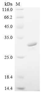 (Tris-Glycine gel) Discontinuous SDS-PAGE (reduced) with 5% enrichment gel and 15% separation gel. (Tris-Glycine gel) Discontinuous SDS-PAGE (reduced) with 5% enrichment gel and 15% separation gel.