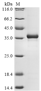 Recombinant Mouse H-2 class I histocompatibility antigen, D-D alpha chain (H2-D1) - image 1