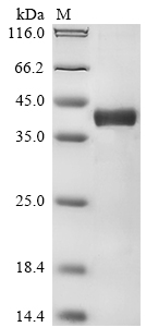 (Tris-Glycine gel) Discontinuous SDS-PAGE (reduced) with 5% enrichment gel and 15% separation gel. (Tris-Glycine gel) Discontinuous SDS-PAGE (reduced) with 5% enrichment gel and 15% separation gel.