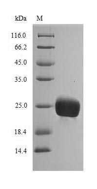 (Tris-Glycine gel) Discontinuous SDS-PAGE (reduced) with 5% enrichment gel and 15% separation gel. (Tris-Glycine gel) Discontinuous SDS-PAGE (reduced) with 5% enrichment gel and 15% separation gel.