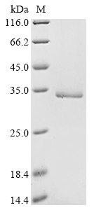 (Tris-Glycine gel) Discontinuous SDS-PAGE (reduced) with 5% enrichment gel and 15% separation gel.