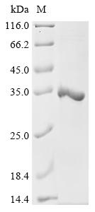 (Tris-Glycine gel) Discontinuous SDS-PAGE (reduced) with 5% enrichment gel and 15% separation gel. (Tris-Glycine gel) Discontinuous SDS-PAGE (reduced) with 5% enrichment gel and 15% separation gel.