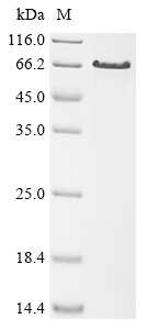 (Tris-Glycine gel) Discontinuous SDS-PAGE (reduced) with 5% enrichment gel and 15% separation gel. (Tris-Glycine gel) Discontinuous SDS-PAGE (reduced) with 5% enrichment gel and 15% separation gel.