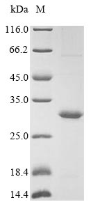 SDS-PAGE- Recombinant protein Epstein-Barr BDLF3