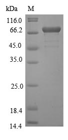 (Tris-Glycine gel) Discontinuous SDS-PAGE (reduced) with 5% enrichment gel and 15% separation gel. (Tris-Glycine gel) Discontinuous SDS-PAGE (reduced) with 5% enrichment gel and 15% separation gel.