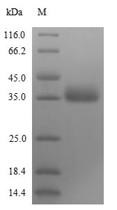 SDS-PAGE- Recombinant protein Influenza NS