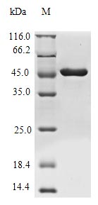 (Tris-Glycine gel) Discontinuous SDS-PAGE (reduced) with 5% enrichment gel and 15% separation gel. (Tris-Glycine gel) Discontinuous SDS-PAGE (reduced) with 5% enrichment gel and 15% separation gel.