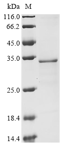 (Tris-Glycine gel) Discontinuous SDS-PAGE (reduced) with 5% enrichment gel and 15% separation gel. (Tris-Glycine gel) Discontinuous SDS-PAGE (reduced) with 5% enrichment gel and 15% separation gel.